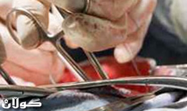 اكتشاف مقص في بطن مريضة بعد مرور 9 اشهر من علاجها!